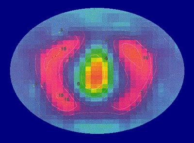 EIT Lung Diagram