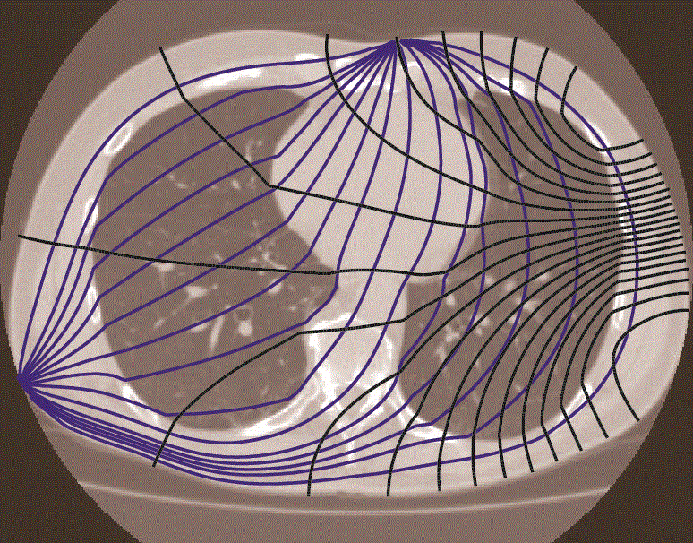 EIT current Diagram